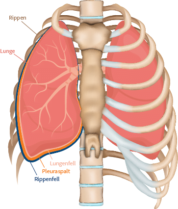 Illustration der Lunge mit Rippenfell, Lungenfell und Pleuraspalt bei gesunden Menschen