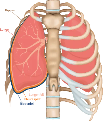 Illustration der Lunge mit Rippenfell, Lungenfell und Pleuraspalt bei gesunden Menschen